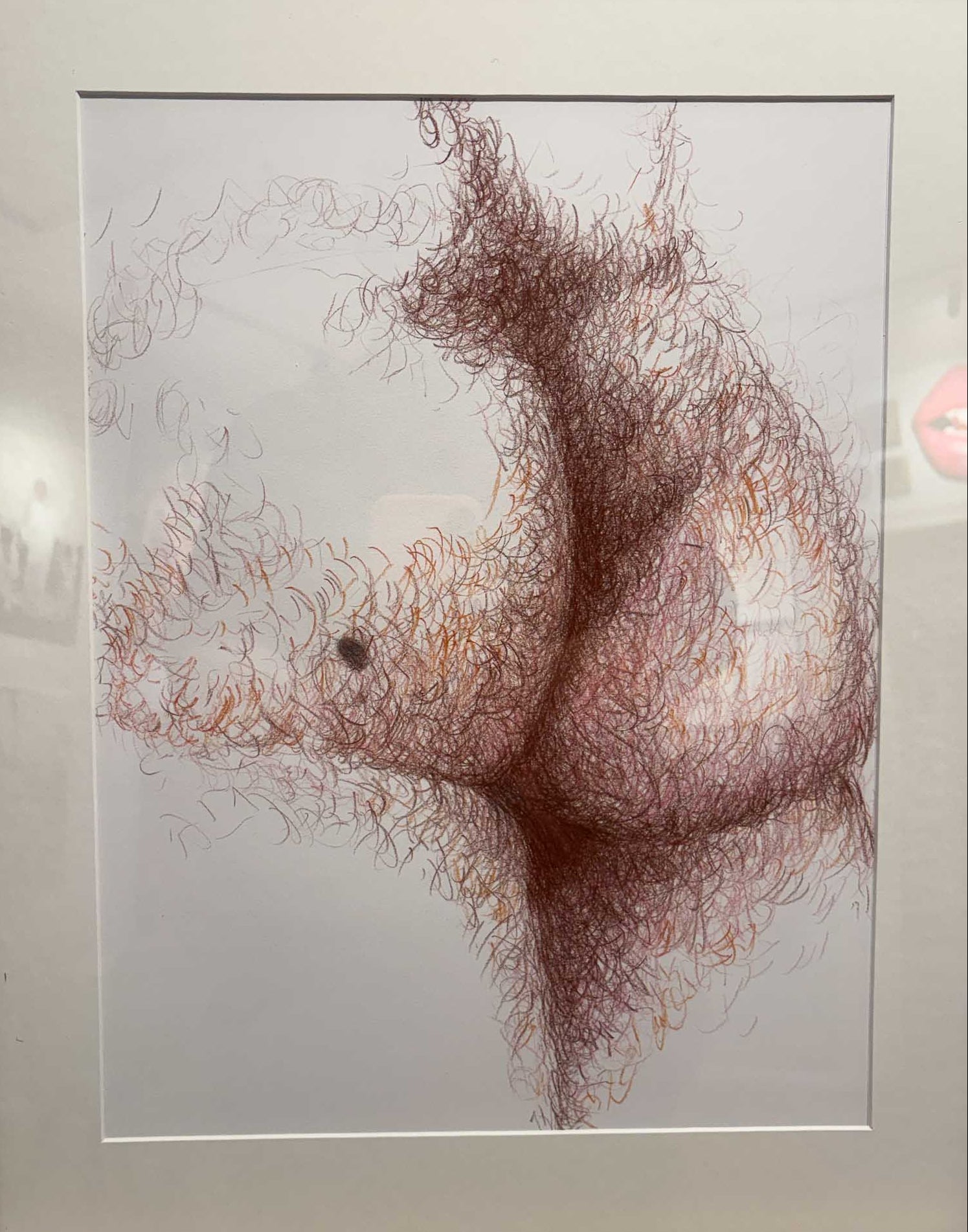 Stefan Thiel / Liver spot